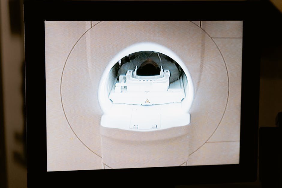 MRI scan showing characteristic mammillary body changes in Wernicke encephalopathy
